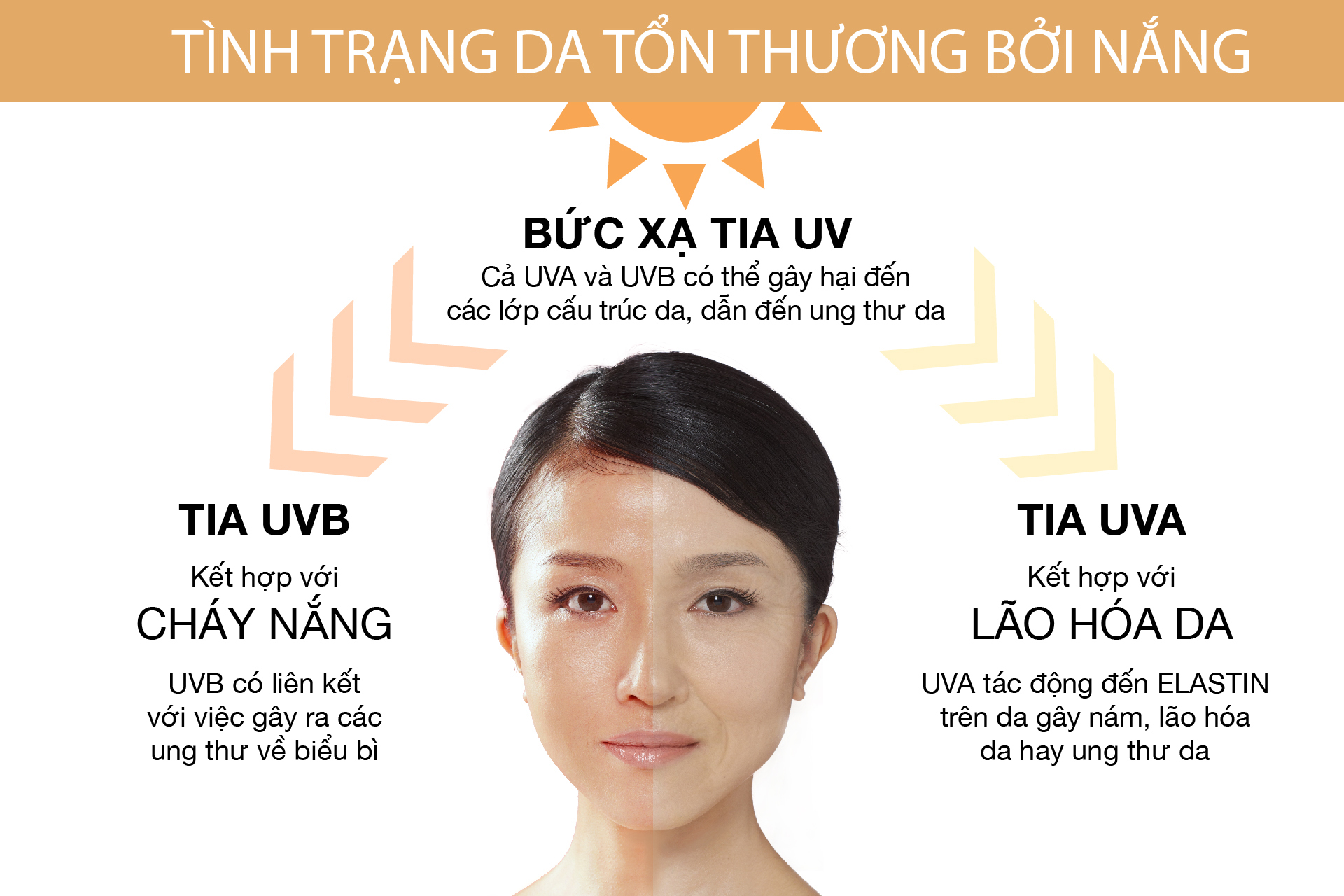 Tác hại của tia UV và cách bảo vệ da hiệu quả với kem chống nắng Kyeon 1 Tác hại của tia UV khiến da sạm màu, xuất hiện nám và tàn nhang.